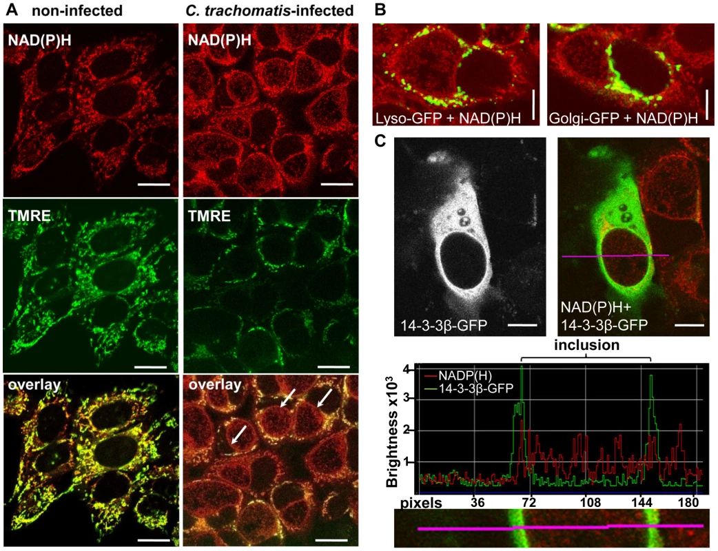 Non-mitochondrial NAD(P)H fluorescence in <i>C. trachomatis</i>-infected cells.
