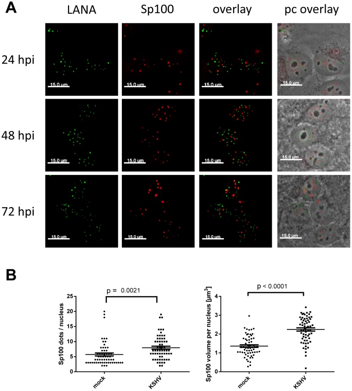 LANA does not co-localize with Sp100, and KSHV infection does not disperse Sp100 from ND10s.