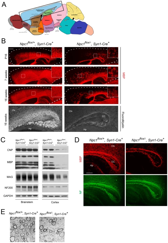 Forebrain dysmyelination in mice following neuron-specific deletion of <i>Npc1</i>.