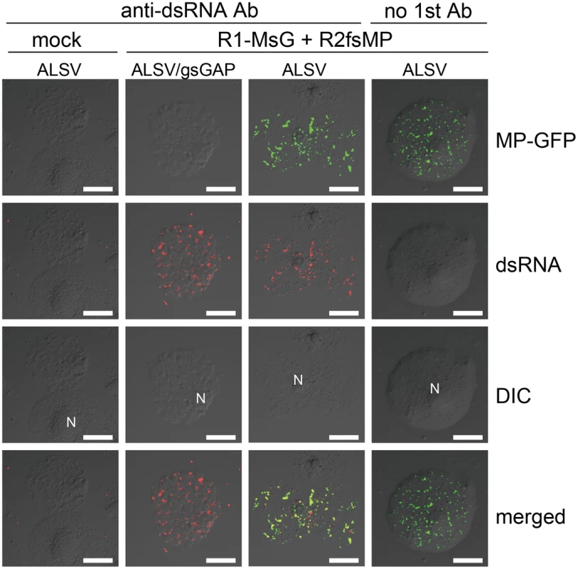 Cortical VRC formation in the <i>NbGAPDH-A</i>-silenced <i>N. benthamiana</i> protoplasts.