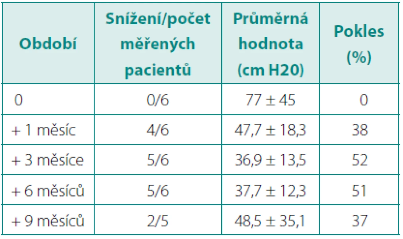 Snížení maximálního intravezikálního tlaku po aplikaci botulinumtoxinu A