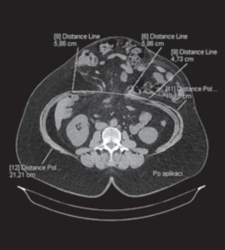 / Fig. 5.