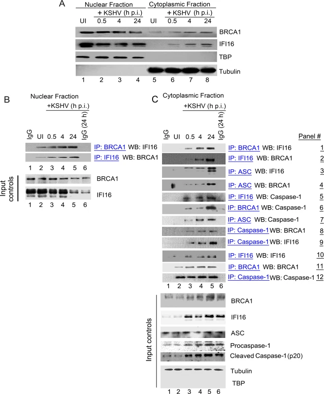 Cytoplasmic distribution of BRCA1 and IFI16 during <i>de novo</i> KSHV infection and BRCA1 is part of the IFI16 inflammasome complex.