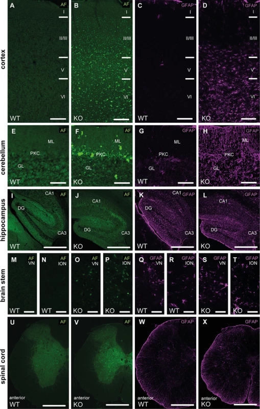 Autofluorescence and GFAP immunoreactivity in different regions of the central nervous system.