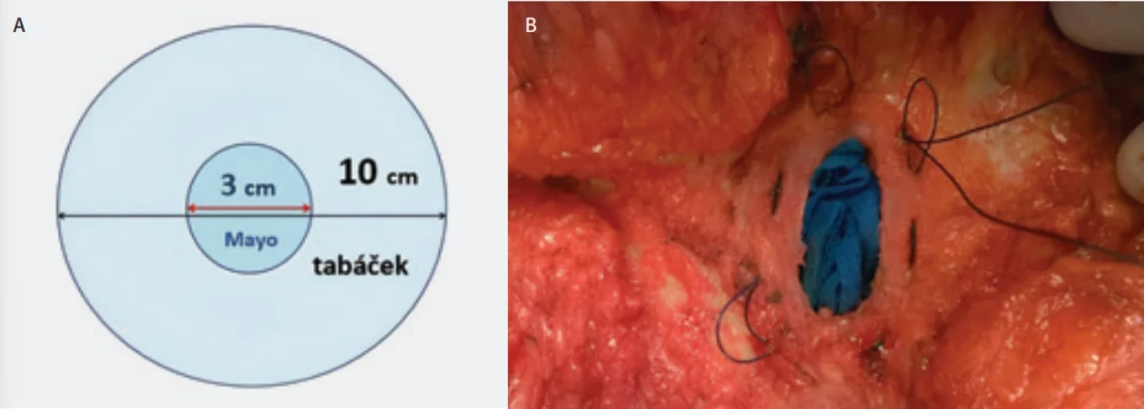  / Fig. 4.