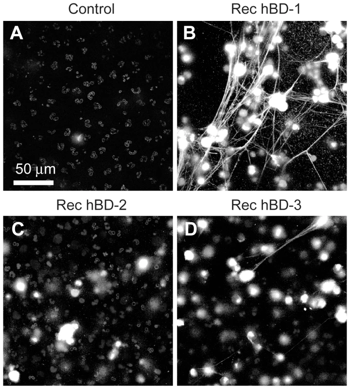 β-defensin 1, but not other β-defensin family members, induce PMNs to form NETs.