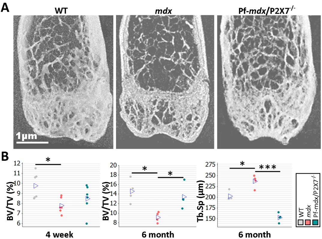 <i>P2RX7</i> ablation reduces <i>mdx</i> bone loss.