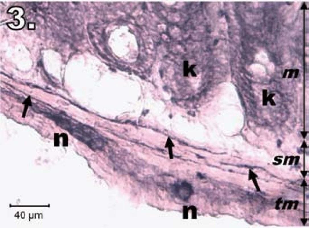 Histologický obraz jejuna v skupine R24. n – regenerujúce sa NADPH-d pozitívne neuróny, šípky – nervové vlákna, k – negatívne Lieberkühnove krypty, m – mukóza, sm – submukóza, tm – tunica muscularis; scale bar = 40 μm
Fig. 3. Histological picture of jejunum in group R24. n – regeneration in NADPH-d positive neurons, arrows – nerve fibres, k – negativity in Lieberkühn's crypts, m – mucosa, sm – submucosal layer, tm – tunica muscularis; scale bar = 40 μm