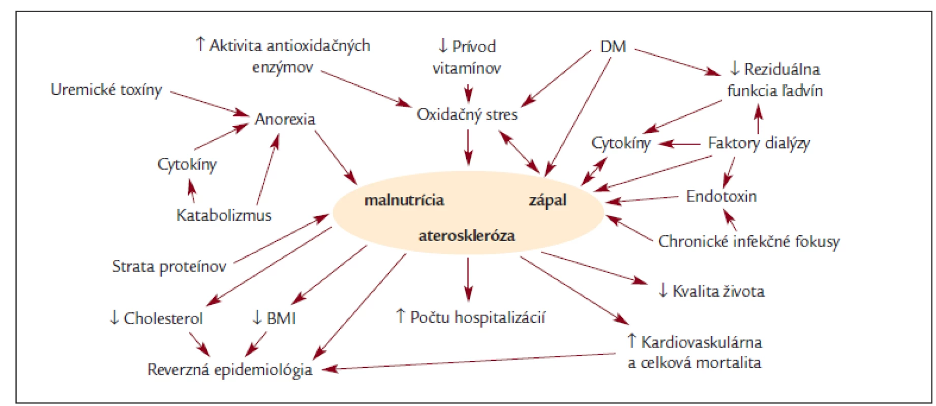 Schéma etiopatogenézie a dôsledkov syndrómu MIA (DM: diabetes mellitus, BMI: body mass index).
