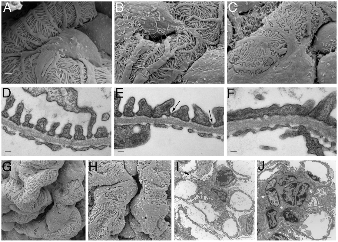 Ultrastructural Analysis of PTIP− Kidneys.