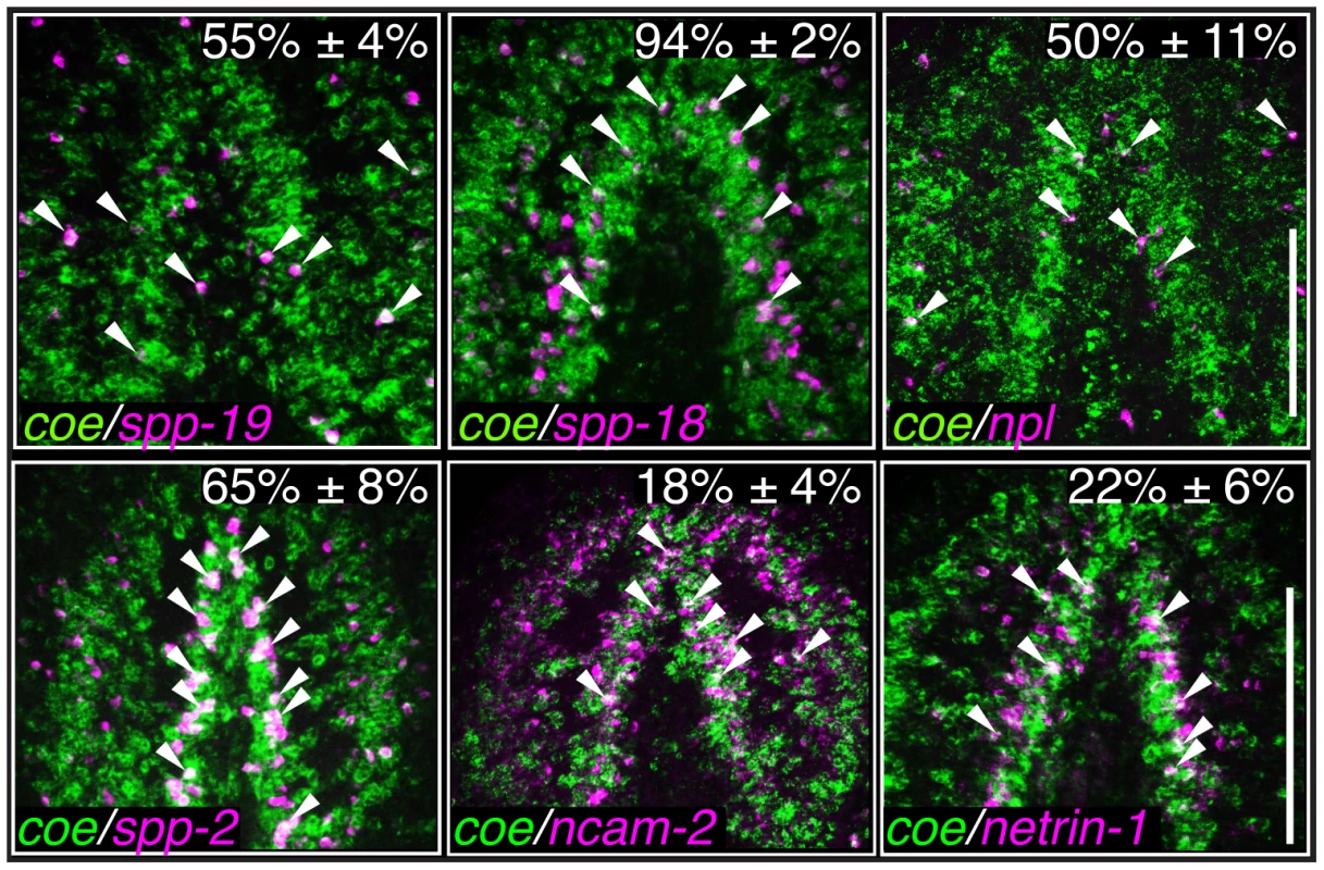 Identification of genes expressed <i>coe<sup>+</sup></i> neurons.