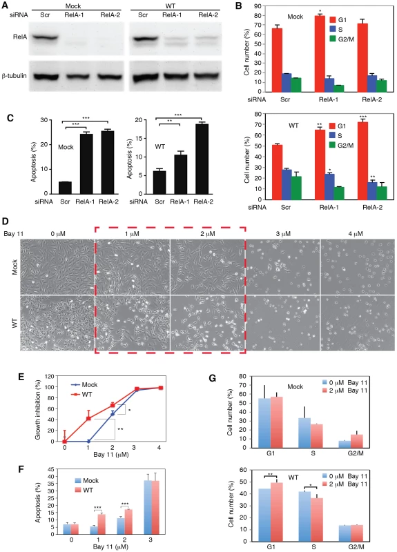 Inhibition of the NF-κB pathway prevents cell cycle progression and induces apoptosis in KSHV-transformed cells.