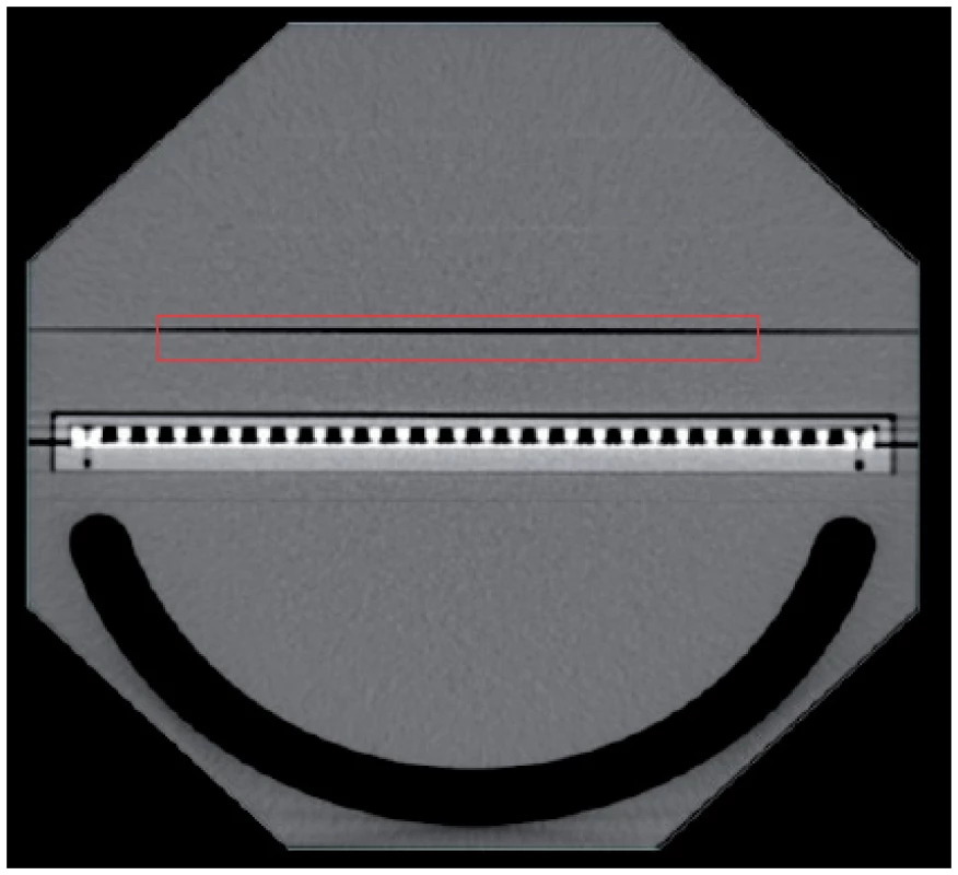 Octavius II CT scan with inserted Seven29 detector (labeled with red rectangle), lower part of the phantom with air gap.