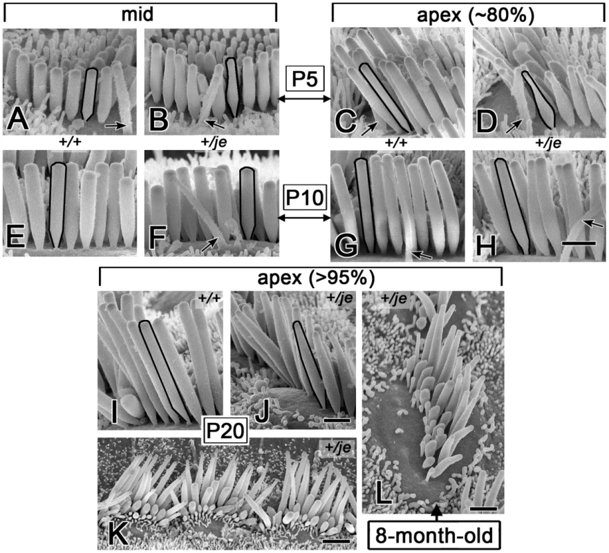 Tapering of stereocilia on the inner hair cells of <i>+/je</i> mice.