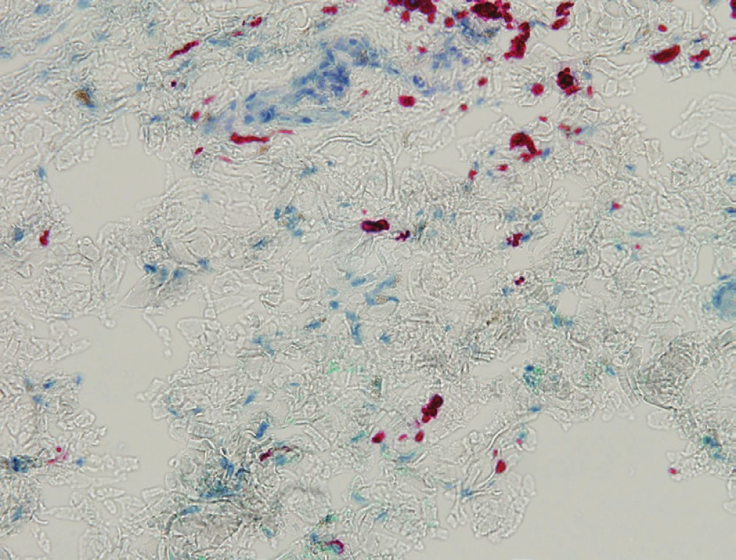 Průkaz melanocytů imunohistochemicky