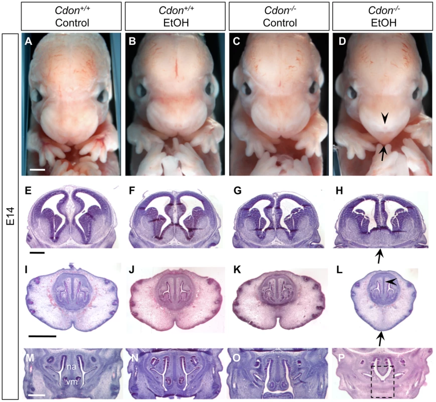 Synergy between loss of <i>Cdon</i> and fetal ethanol exposure produces HPE: E14.0.