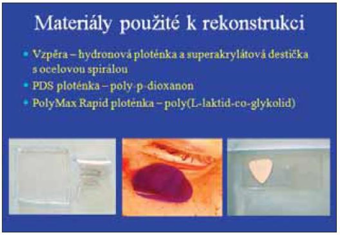Materiály použité k rekonstrukci.
