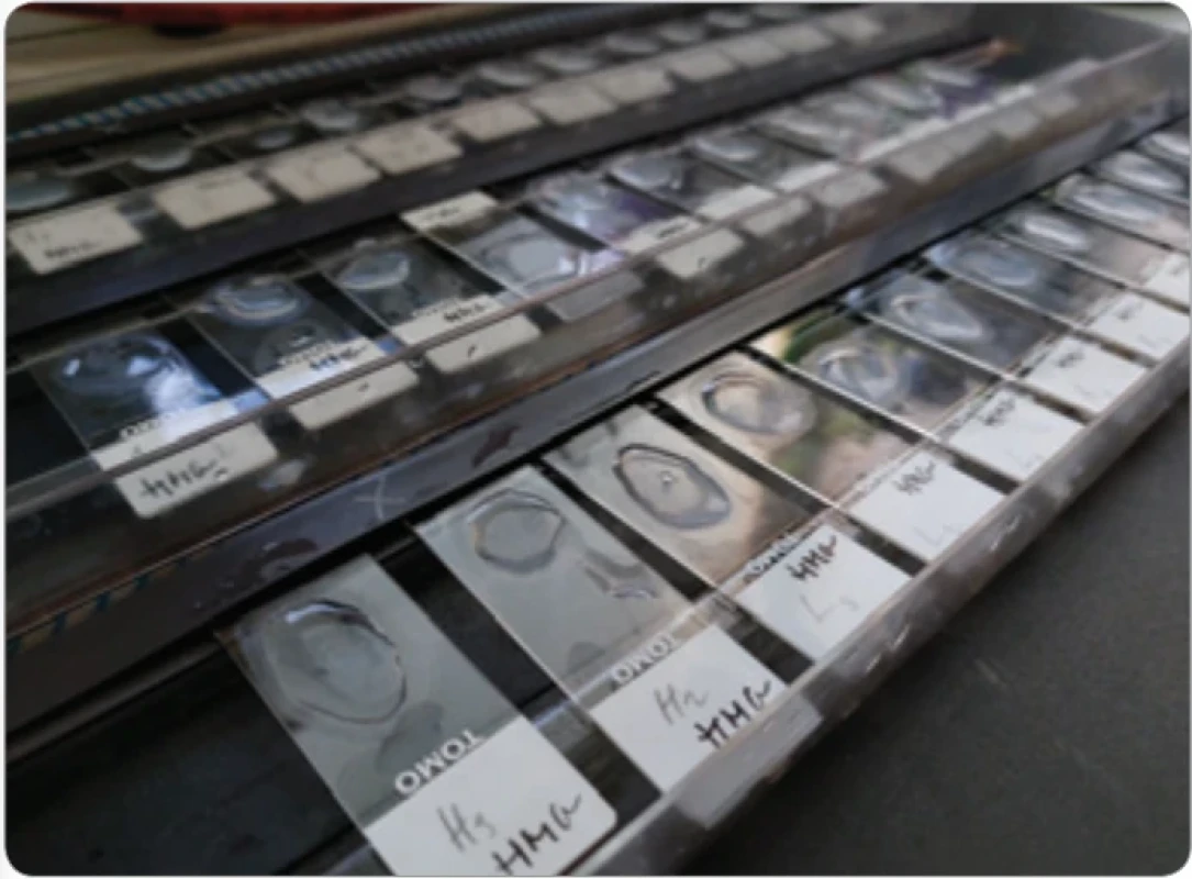 Histologické preparáty připravené pro imunohistochemickou analýzu.