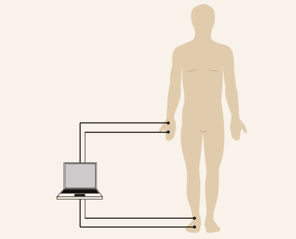 Two electrodes are placed on the right hand
and foot for bioimpedance measurement.<br>
Modified according to [13]