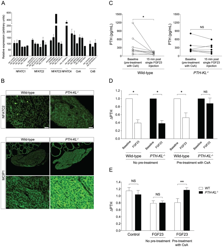 Presence of the calcineurin-NFAT pathway and the impact of cyclosporin A on FGF23 treatment.