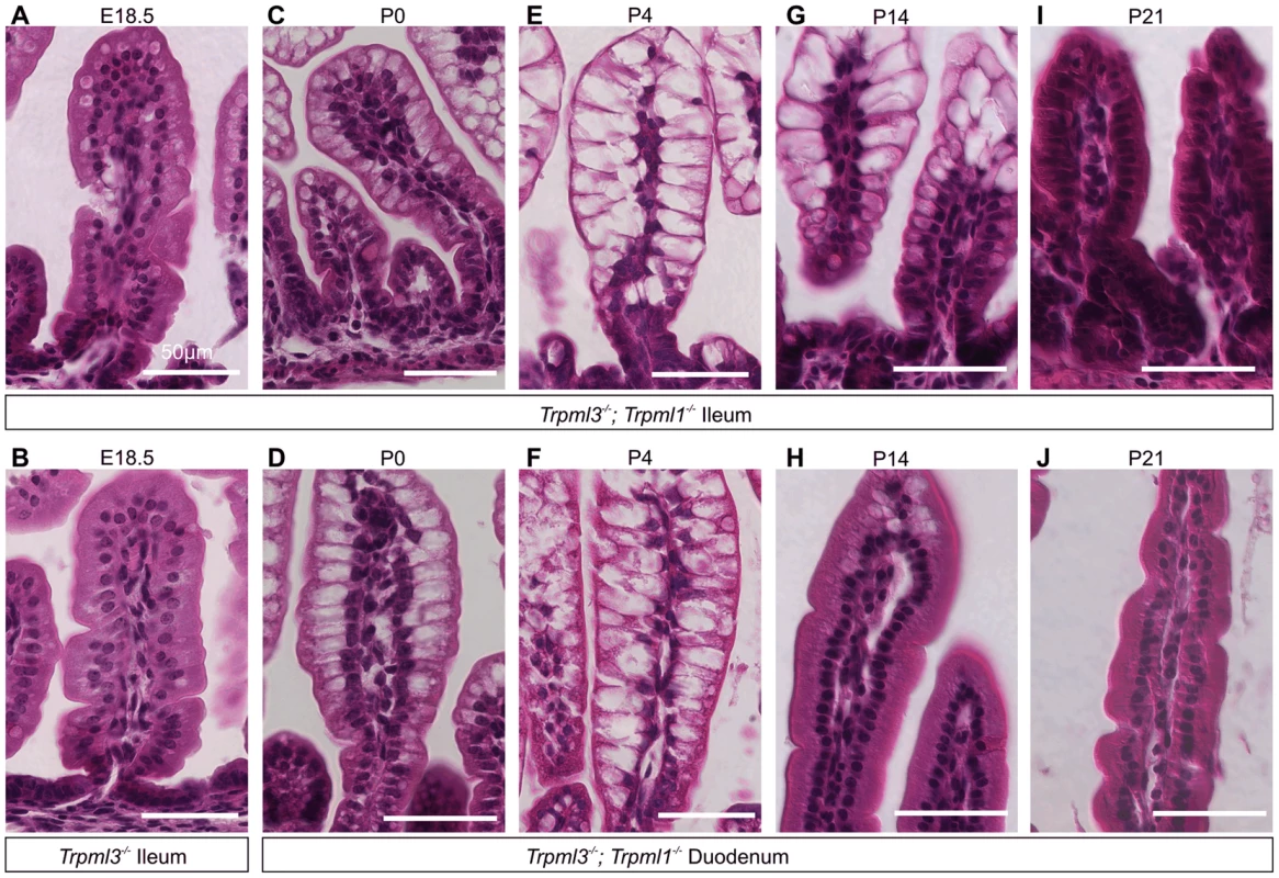 Pathological vacuolation of enterocytes from <i>Trpml3<sup>−/−</sup>;Trpml1<sup>−/−</sup></i> mice is restricted to period of suckling, from birth to weaning.