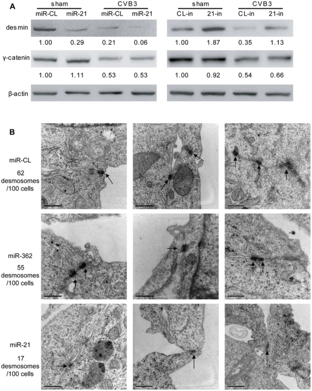 miR-21 downregulates desmin and disrupts desmosome structures.