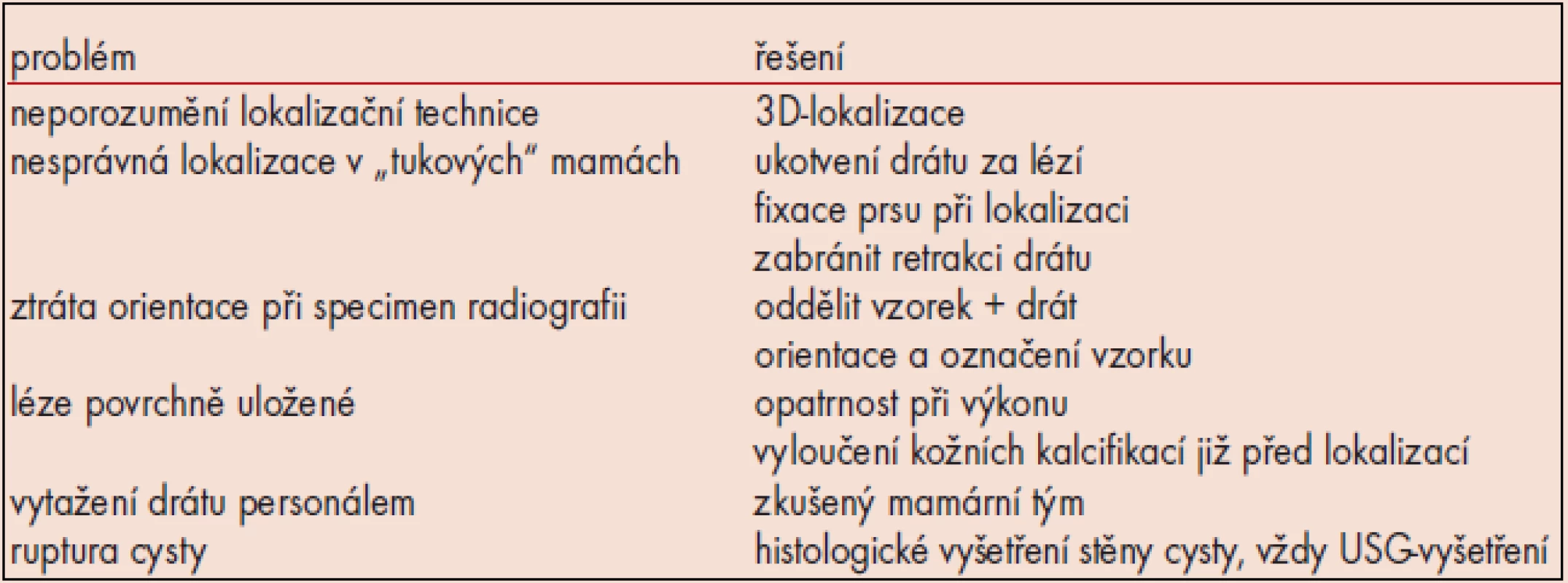 Některé z příčin nedokonalé lokalizace.