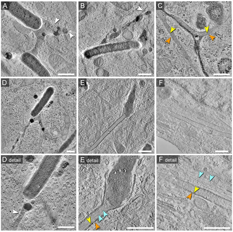 Morphology of SCV and SIT analyzed by EM tomography.