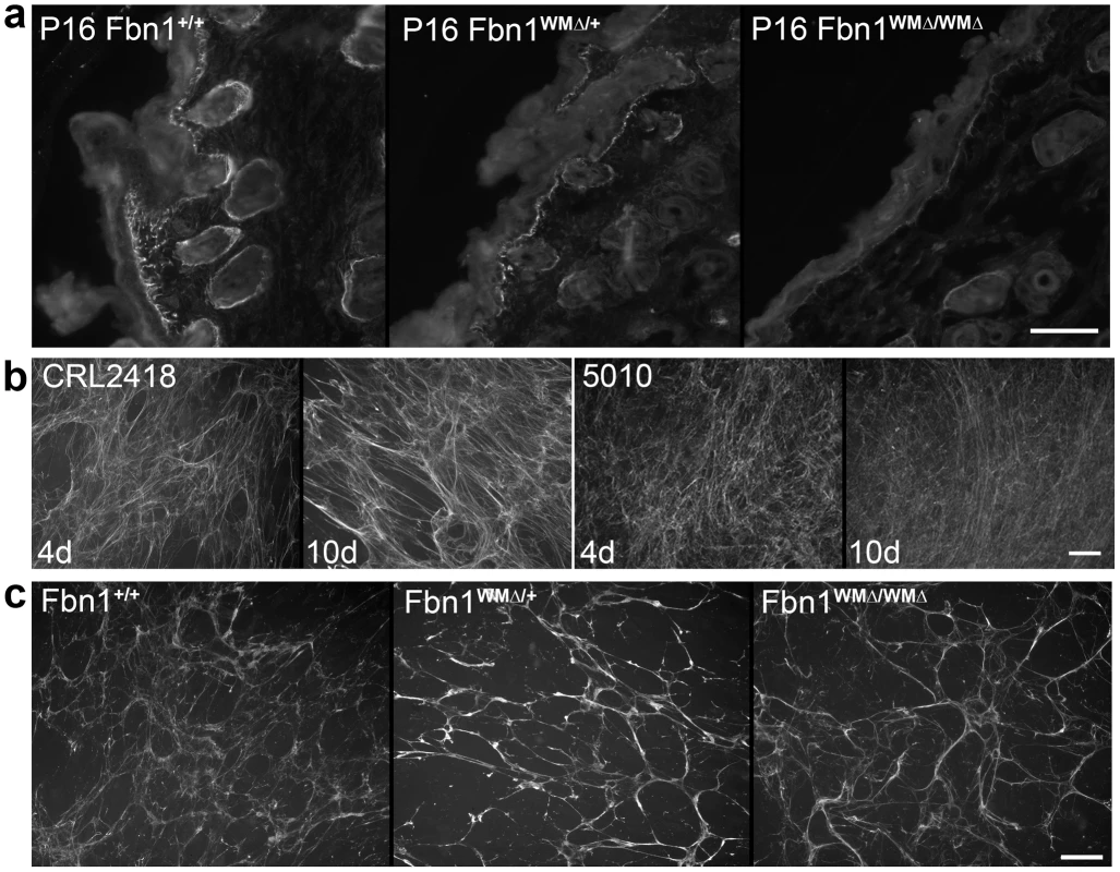 Immunofluorescence analyses of WMS skin and fibroblast cultures.