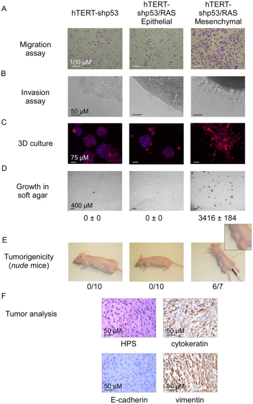 Characterization of epithelial and mesenchymal hTERT-shp53/RAS HMEC-derivative subpopulations.