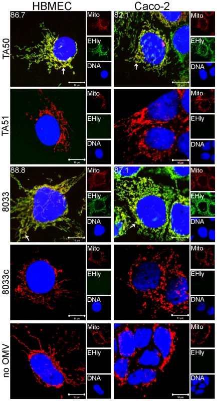 EHEC-Hly colocalizes with mitochondria.