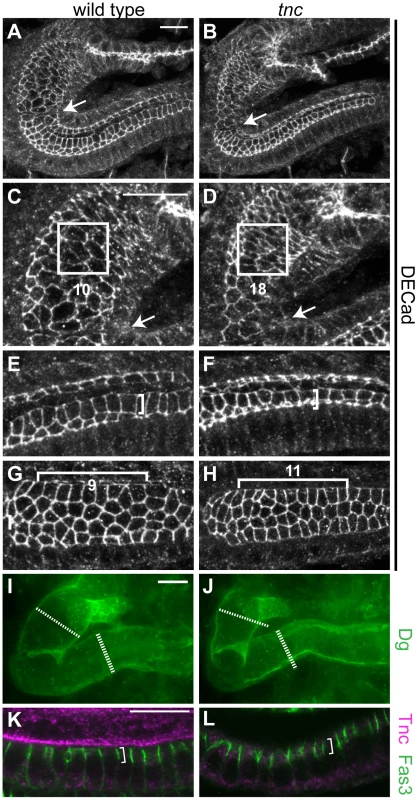Loss of <i>tnc</i> causes reduced apical cell circumferences, altered cell arrangement, and a smaller outer tube diameter.