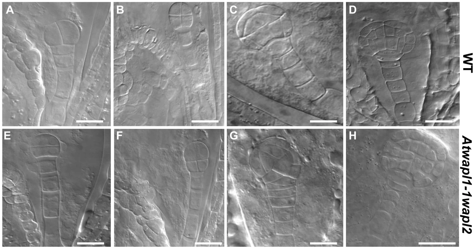 Embryonic patterning is defective in the seeds of <i>Atwapl1-1wapl2</i> plants.