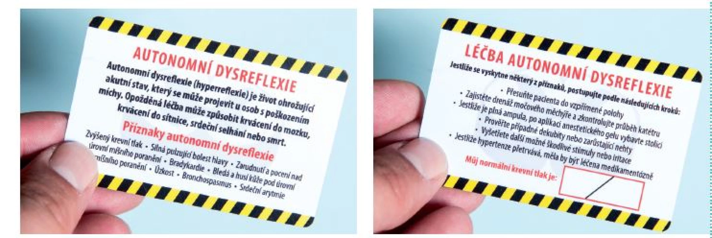Informační karta pro pacienta – přední a zadní strana karty
Fig. 1. Information card for patient – front and back of the card