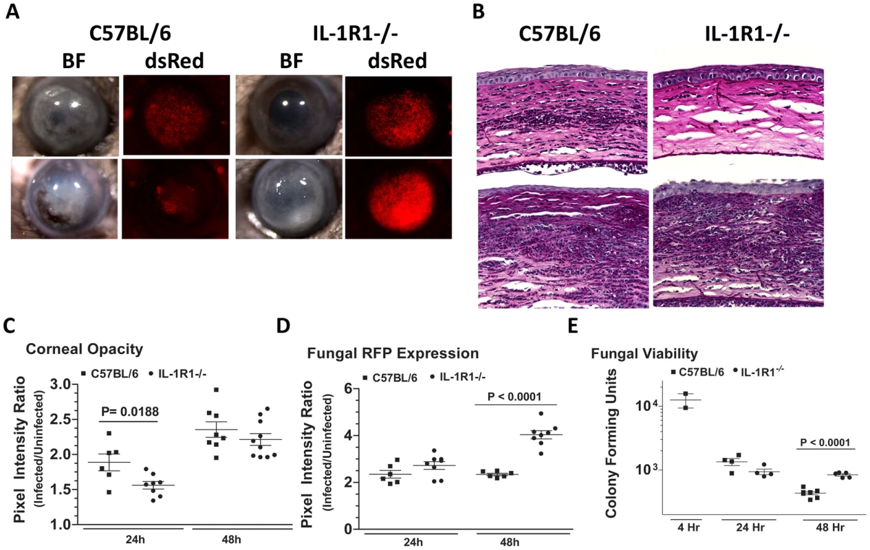 The role of IL-1R1 in <i>A. fumigatus</i> keratitis.