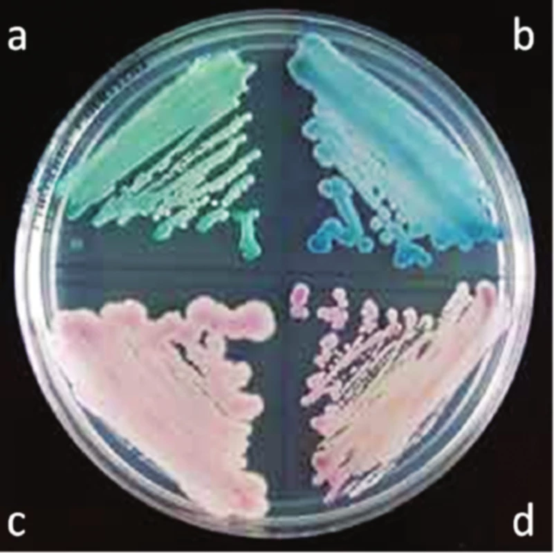 Kultivace rodu Candida na chromogenním agaru<sup>20</sup>)
a – C. albicans, b – C. tropicalis, c – C. parapsilosis, d – C. glabrata,
