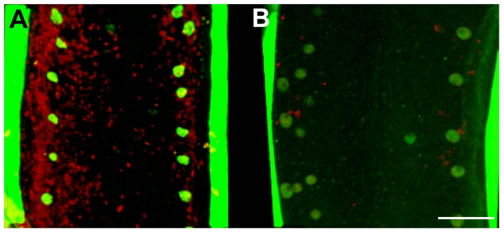 <i>In vivo</i> tetracycline treatment dramatically reduces the <i>Wolbachia</i> population in adult <i>B. malayi</i> females.