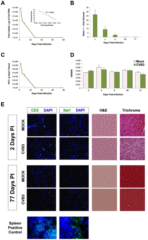 No discernible cardiac hypertrophy or immunopathology in the adult heart following juvenile CVB3 infection.