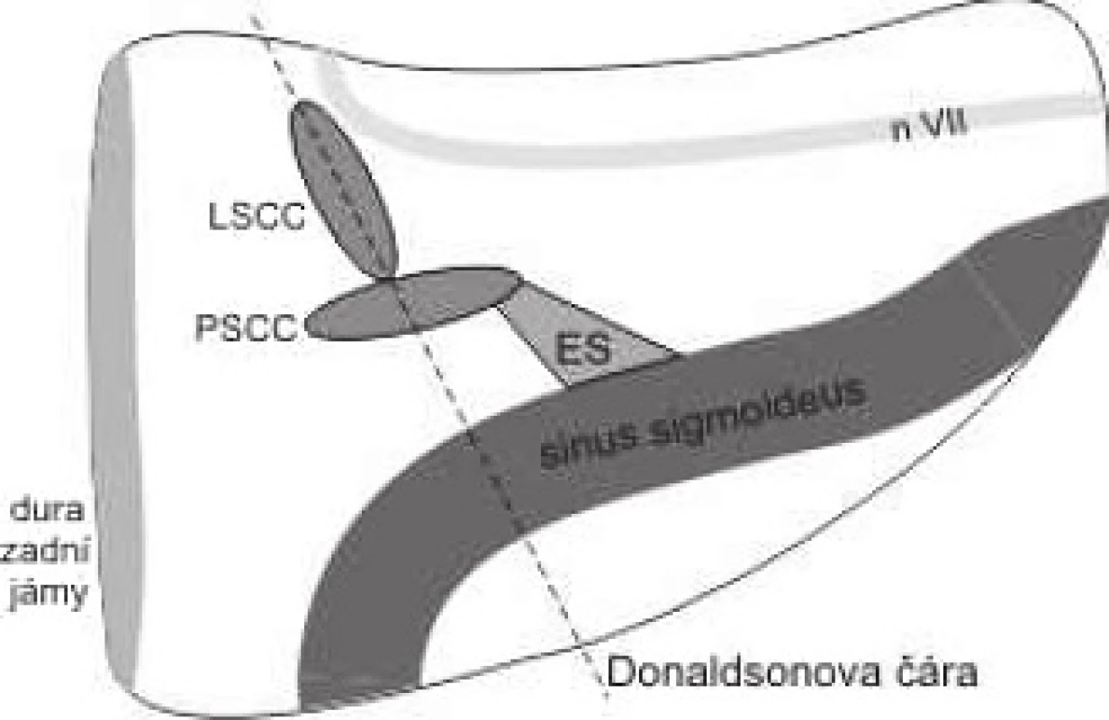 Endolymfatický vak.
