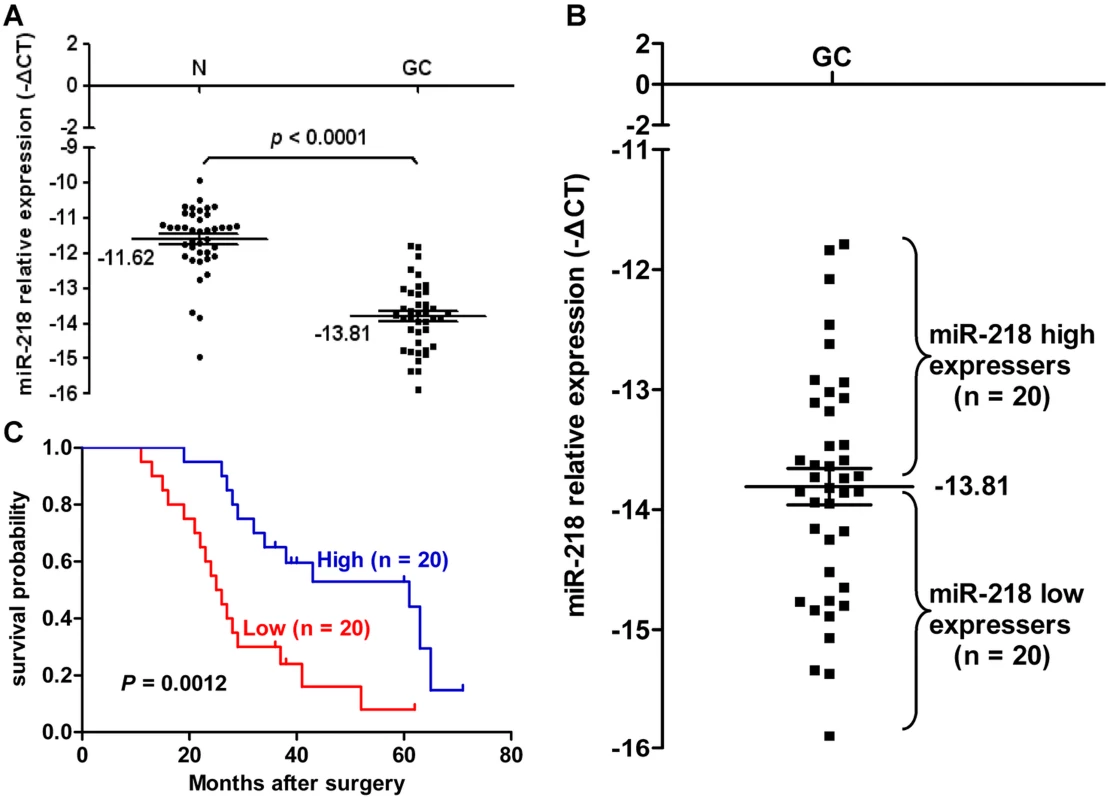 miR-218 expression in clinical GC specimens.