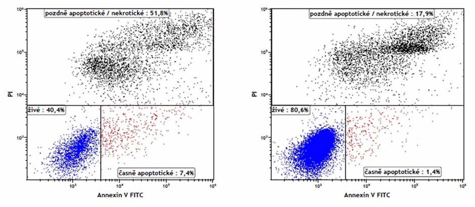 Stanovení apoptotických spermií průtokovou cytometrií v ejakulátu normozoospermiků. Annexin V – FITC (AN) a propidium jodid (PI) byly použity k rozdělení buněk na živé spermie (AN-PI-), časně apoptotické spermie (AN+ PI–), mrtvé a pozdně apoptotické spermie (PI+). Fyziologická hodnota je >50 % živých spermií v ejakulátu. Vlevo – ApoHigh vzorek, Vpravo – ApoLow vzorek
Fig. 1. Flow cytometry analysis of apoptotic sperm in normozoospermic semen. Annexin V-FITC (AN) and propidium iodide (PI) were used to discriminate the viable sperm (AN+ PI–), early apoptotic sperm (AN– PI–) and necrotic plus late apoptotic sperm (PI+) in flow cytometry analysis. The physiological value is >50 % viable sperm in semen. Left – ApoHigh sample, right – ApoLow sample