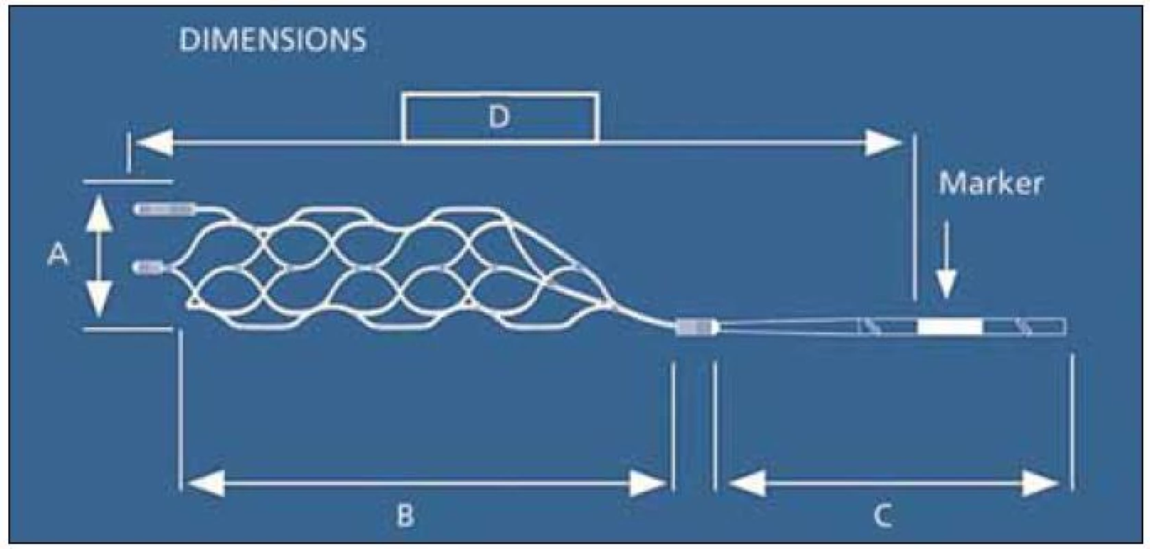 pRESET Thrombectomy Retriever<sup>®</sup> (Phenox GmbH, Bochum, SRN).
Available from: URL: http//www.phenox.info.