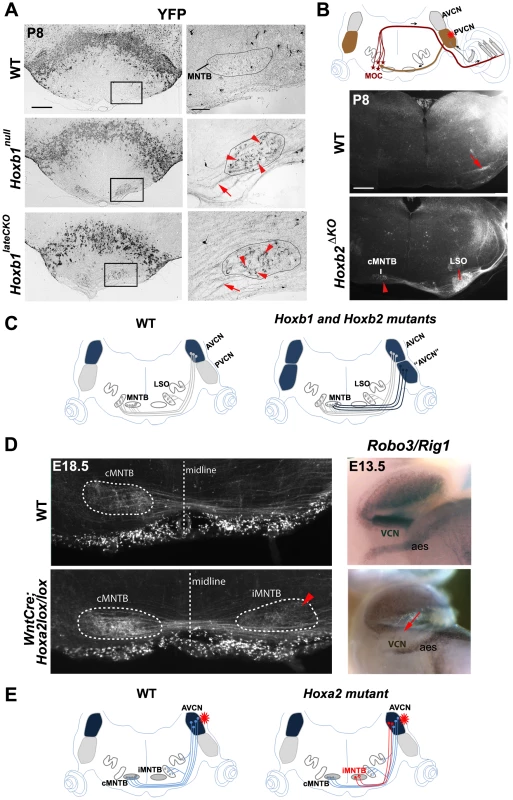 Abnormal cochlear connectivity in <i>Hoxb1</i>, <i>Hoxb2</i> and <i>Hoxa2</i> mutants.