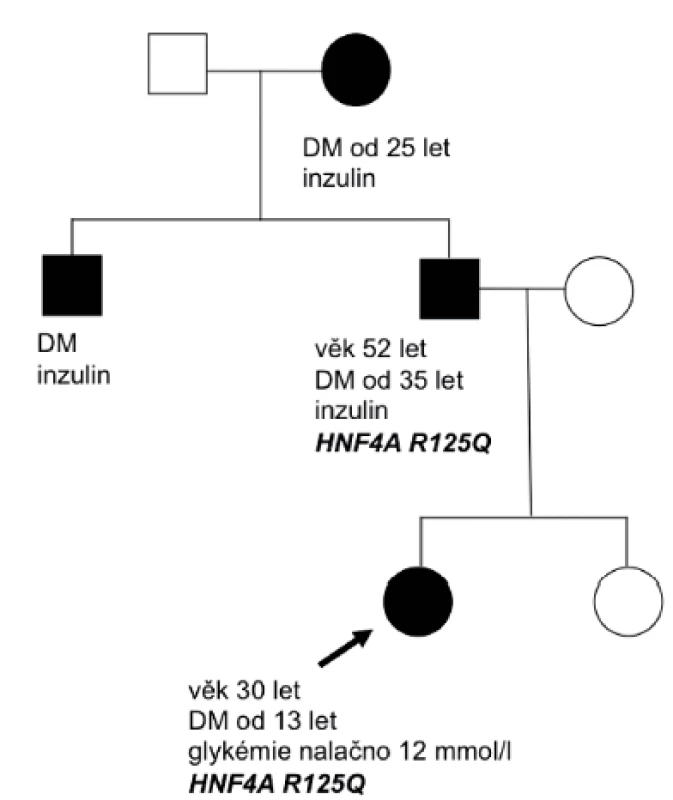 Rodokmen rodiny nesoucí mutaci v genu HNF4A. Probandem byla 13letá pacientka s náhodným záchytem DM. Markery
autoimunitní inzulitidy byly negativní a pozitivita C-peptidu trvala déle než 3 roky. Diabetes mellitus se v rodině vyskytoval
ve 3 generacích. Jedinci byli vedeni pod diagnózou diabetes mellitus 1. typu a měli závažné diabetické komplikace. Babička
a strýc probandky odmítli podstoupit genetické vyšetření.