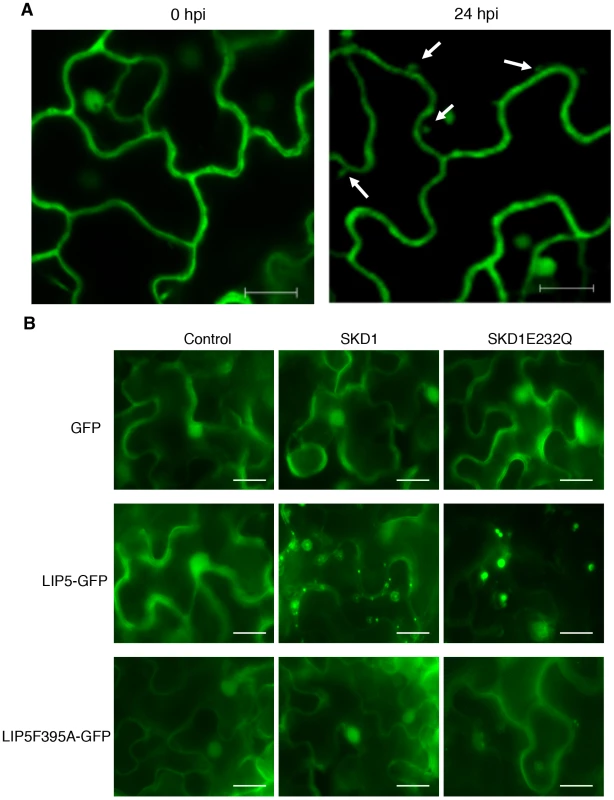 Subcellular localization of LIP5.