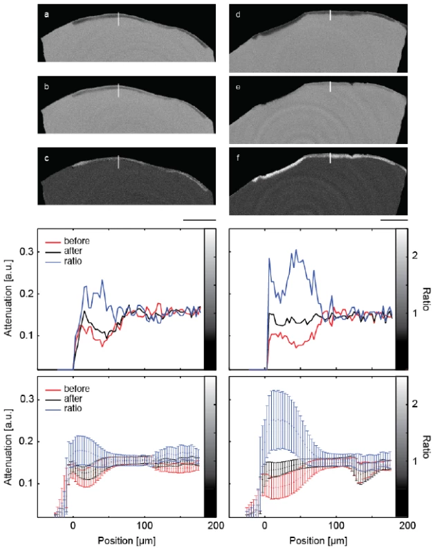 The images show selected slices of the μCT-data from the two pieces of the crown through the induced lesions. The images (a) and (d) are obtained before treatment. The related slices of the μCT-data after the treatment are images (b) and (e), (b) being the control and (e) the specimen treated with the peptide. Images (c) and (f) show the ratio of the attenuation values. The length bar corresponds to 500 μm. The diagrams in the central row show selected line plots through the lesion with locations indicated by the white lines in the images above. The increased mineral content caused by the mineralization treatments is clearly indicated. In the diagrams in the bottom row, the attenuation in the lesions is plotted against the distance from the specimen surface, integrated over the entire specimen. Error bars correspond to the standard deviation.