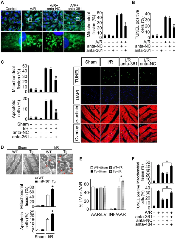 miR-361 provokes mitochondrial fission program.