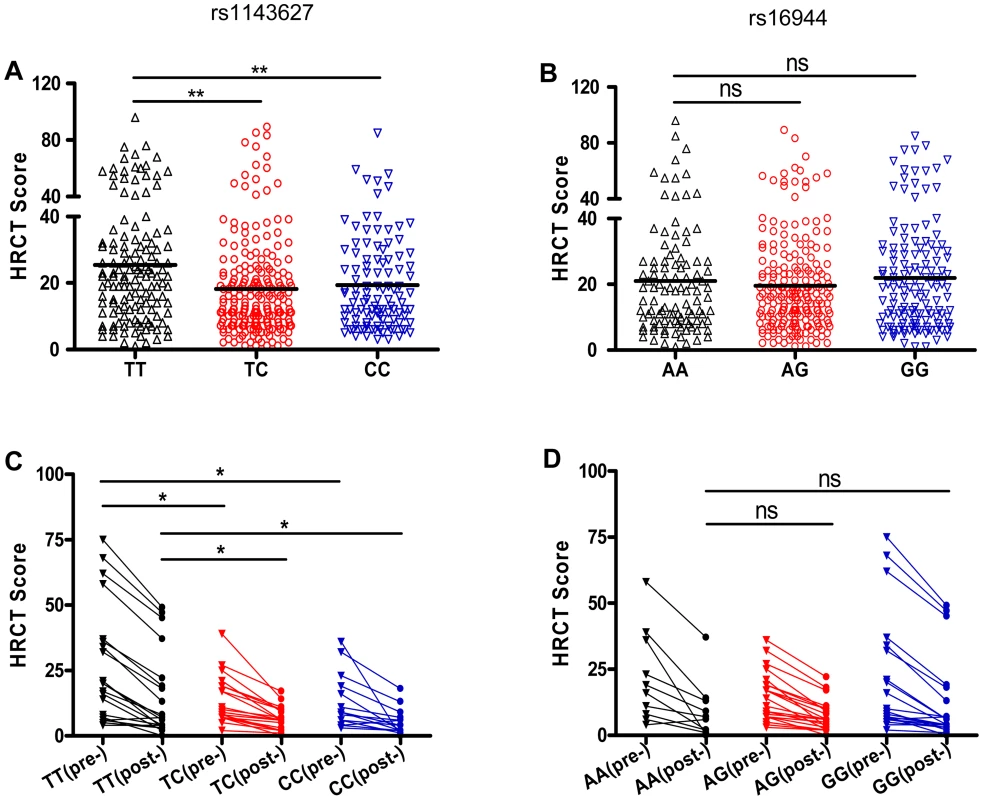 SNP rs1143627 is associated with the severity of pulmonary TB disease.