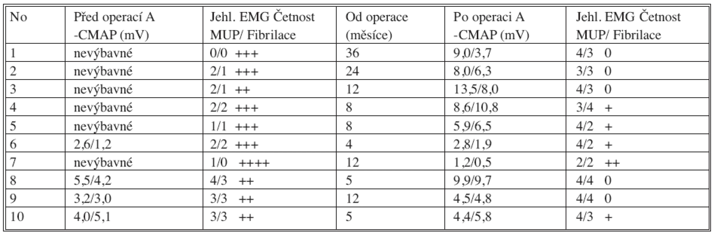 Elektromyografické vyšetření před operací a s odstupem (v měsících) po operaci. Amplituda sumačního svalového evokovaného potenciálu (A-CMAP) snímaná z m. supraspinatus a m. infraspinatus je vyjádřena v mV. Četnost akčních potenciálů motorických jednotek (MUP) je ve zdravém svalu 5 při maximální kontrakci. V tabulce je vyjádřena zlomkem (m. supraspinatus/m. infraspinatus). Četnost fibrilací (projev denervačního syndromu) je hodnocena sumačně pro svaly, a to podle stupnice 0 až ++++
Tab. 2. Electromyographic examination prior to the procedure and after (several months) the procedure. The compound muscle action potential amplitude (A-CMAP) recorded from the supraspinatus and the infraspinatus muscle is expressed in mV. During the maximum contraction of a healthy muscle 5 motor unit action potentials (MUP) have been recorded. In the table, the frequency is presented as a broken number (m. supraspinatus/m. infraspinatus). The frequency of fibrillations (a denervation syndrome sign) is assessed as a compound muscle measure, based on the 0 to ++++ scale.
