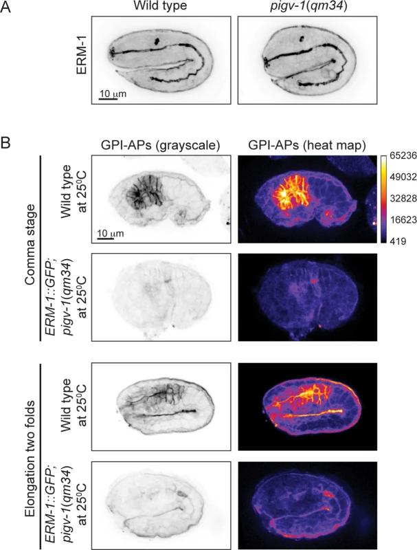 ERM-1 overexpression does not rescue GPI-AP biosynthesis in <i>pigv-1</i>(<i>qm34</i>).